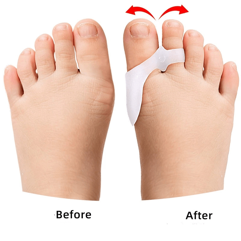 1/2/3 Pary Żelowych Separatoró – Toe Separator Silicon recenzja i cena