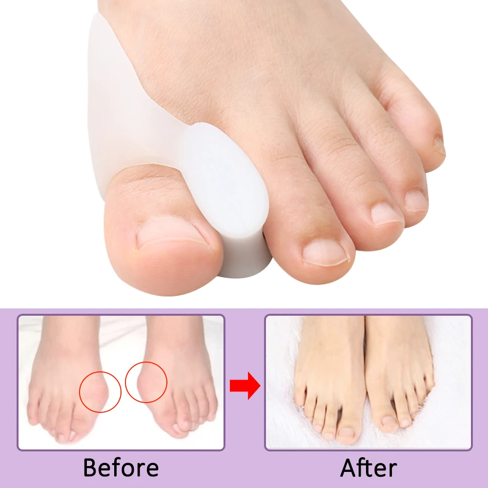 2/4/8 szt. Żelowe separatory p – Toe Separator Silicon recenzja i cena
