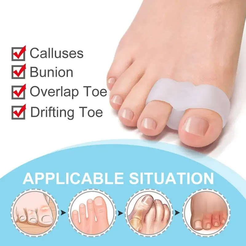 Korektor na haluksy 1 para - W – Toe Separator Silicon recenzja i cena