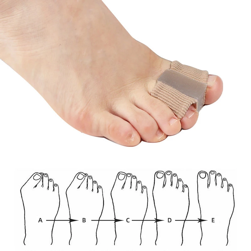 Żelowe separatory palców stopy – Toe Separator Silicon recenzja i cena