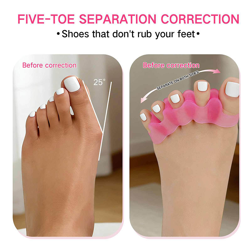 1 Para Silikonowych Separatoró – Toe Separator Silicon recenzja i cena